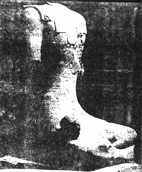 Statues du "dieu assis" trouvées dans les fouilles de Roquepertuse